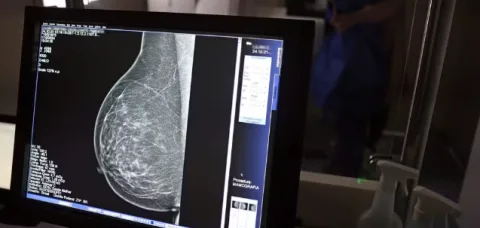 Carreta oferece mamografias gratuitas em Feira de Santana, Jequié e Alagoinhas