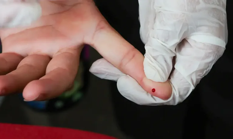 Julho Amarelo: Alagoinhas mobiliza saúde pública contra as hepatites virais e realiza “Dia D” de testagem rápida
